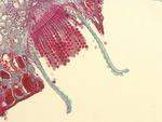 MISSING THUMBNAIL